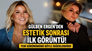 Gülben Ergenden estetik sonrası ilk görüntü Yeni görünümünü böyle değerlendirdi